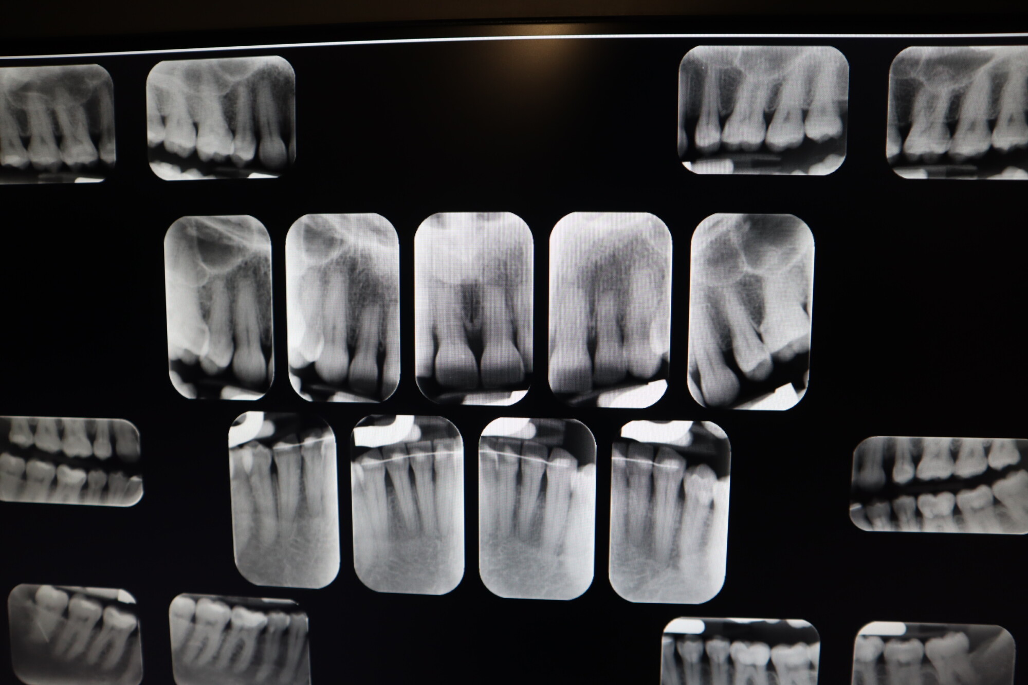 Imagerie dentaire bilan long cone